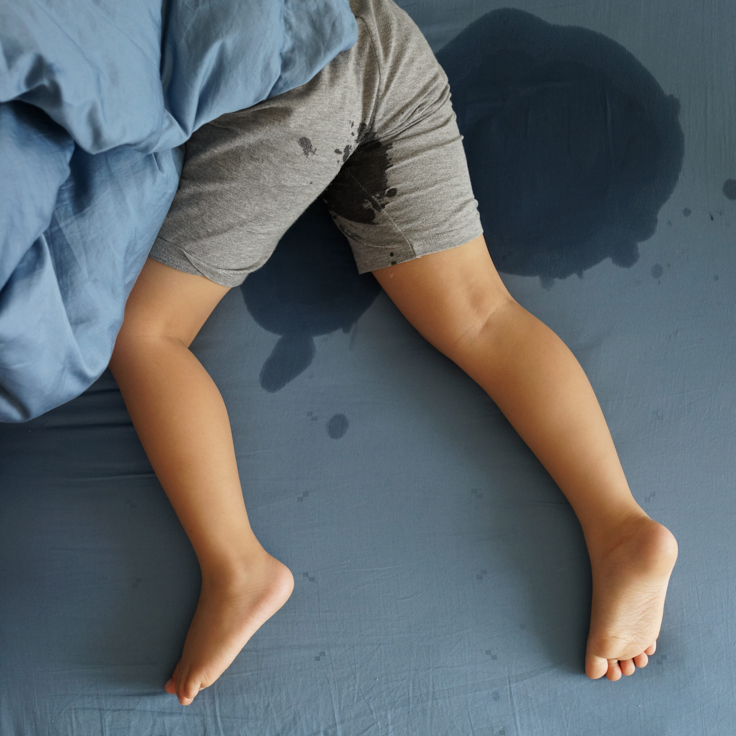 Family supporting someone experiencing bedwetting